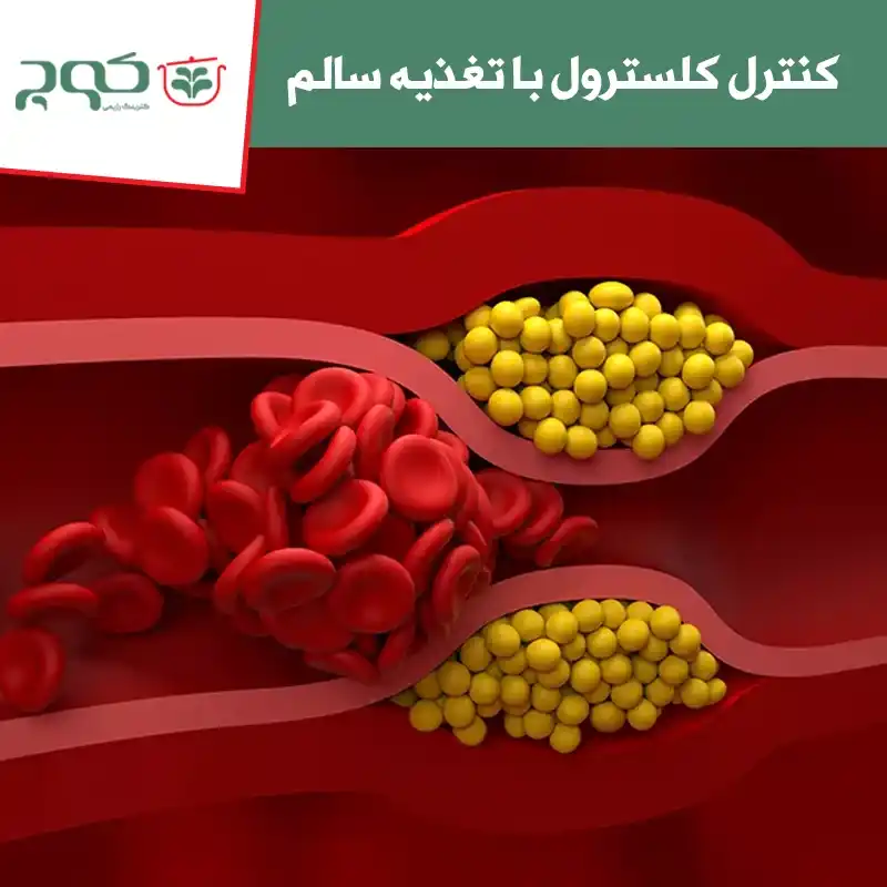 کنترل کلسترول با تغذیه